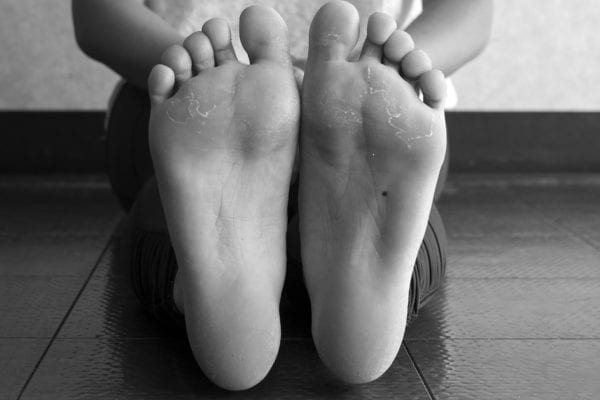 Wholesale Pedicure Products: Extra Strength Callus Remover Gel